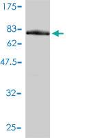 Anti-RNMT Mouse Monoclonal Antibody [clone: 3H3-1D12]