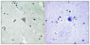 Immunohistochemical analysis of paraffin-embedded human brain using Anti-HER3 (phospho Tyr1328) Antibody 1:100 (4°C overnight). The right hand panel represents a negative control, where the antibody was pre-incubated with the immunising peptide.