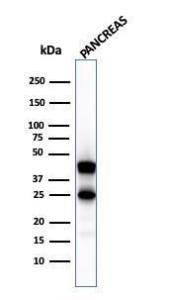 Anti-Carboxypeptidase A1 Mouse Monoclonal Antibody [clone: CPA1/2711]