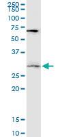 Anti-DKK1 Mouse Monoclonal Antibody [clone: 4C10]