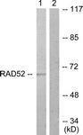 Anti-DPYSL2 Rabbit Polyclonal Antibody