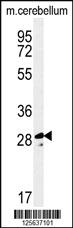 Anti-TESC Rabbit Polyclonal Antibody