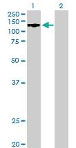 Anti-LARP1 Mouse Polyclonal Antibody