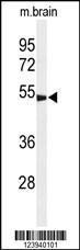 Anti-GABRG3 Rabbit Polyclonal Antibody (Biotin)