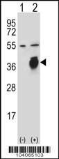 Anti-PLAUR Rabbit Polyclonal Antibody (PE (Phycoerythrin))