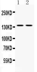 Anti-ABL2 Antibody