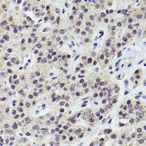 Anti-PMS2 Rabbit Monoclonal Antibody [clone: ARC2479]