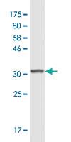 Anti-RAD1 Mouse Monoclonal Antibody [clone: 1G2]