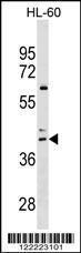 Anti-CCR4 Rabbit Polyclonal Antibody (FITC (Fluorescein Isothiocyanate))