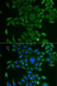 Immunofluorescence analysis of U2OS cells using Anti-CCBL1 Antibody (A11987). DAPI was used to stain the cell nuclei (blue)