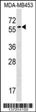 Anti-FSD1 Rabbit Polyclonal Antibody