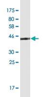 Anti-BLOC1S2 Mouse Monoclonal Antibody [clone: 8C10]