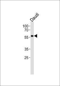 Anti-TP53 Rabbit Polyclonal Antibody (Biotin)