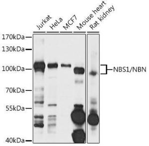 Western blot analysis of extracts of various cell lines, using Anti-p95/NBS1 Antibody (A306665) at 1:1,000 dilution