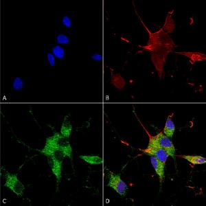 Immunocytochemistry/Immunofluorescence analysis of human neuroblastoma cells (SH-SY5Y), fixed in 4% PFA for 15 min, using Anti-SHANK3 Antibody [S367-51] (A304719), at 1:100 for overnight at 4°C with slow rockin