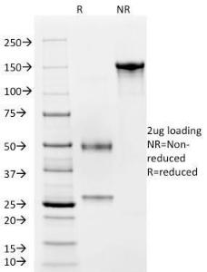 SDS-PAGE analysis of Anti-CD4 Antibody [C4/206] under non-reduced and reduced conditions; showing intact IgG and intact heavy and light chains, respectively. SDS-PAGE analysis confirms the integrity and purity of the antibody.