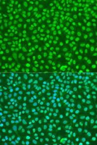 Immunofluorescence analysis of U2OS cells using Anti-p95/NBS1 Antibody (A306665) at a dilution of 1:100. DAPI was used to stain the cell nuclei (blue)