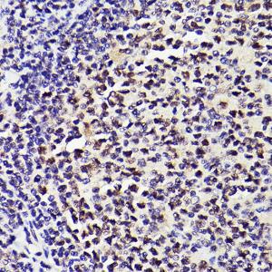 Anti-PMS2 Rabbit Monoclonal Antibody [clone: ARC2479]