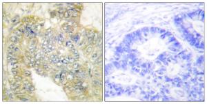 Antibody anti-DESMIN phospho SER60 100 µg