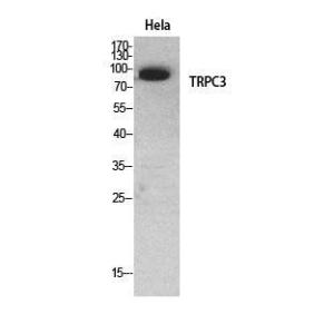 Western blot analysis of HeLa cells using Anti-TRPC3 Antibody