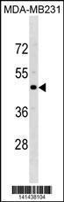 Anti-CCR5 Rabbit Polyclonal Antibody (AP (Alkaline Phosphatase))