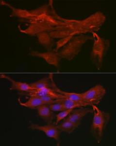 Anti-MyD88 antibody