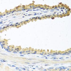 Immunohistochemistry analysis of paraffin-embedded human prostate using Anti-COCH Antibody (A11989) at a dilution of 1:100 (40X lens). Perform microwave antigen retrieval with 10 mM PBS buffer pH 7.2 before commencing with IHC staining protocol