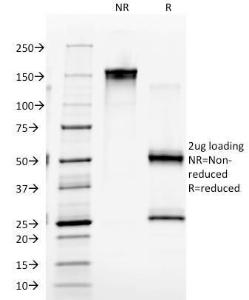 SDS-PAGE analysis of Anti-CD4 Antibody [EDU-2] under non-reduced and reduced conditions; showing intact IgG and intact heavy and light chains, respectively. SDS-PAGE analysis confirms the integrity and purity of the antibody