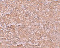 Anti-SLC39A14 Rabbit Polyclonal Antibody