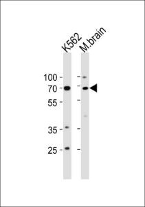 Anti-TP73 Rabbit Polyclonal Antibody (APC (Allophycocyanin))