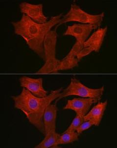 Anti-MyD88 antibody