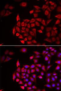 Immunofluorescence analysis of HeLa cells using Anti-COCH Antibody (A11989). DAPI was used to stain the cell nuclei (blue)