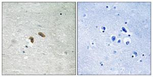 Immunohistochemical analysis of paraffin-embedded human brain using Anti-C-RAF (phospho Thr269) Antibody The right hand panel represents a negative control, where the antibody was pre-incubated with the immunising peptide