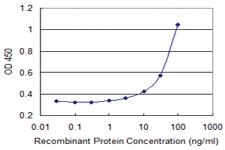 Anti-ATP8B1 Mouse Monoclonal Antibody [clone: 3F10]