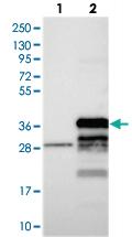 Anti-FAM92B Rabbit Polyclonal Antibody