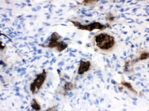 Anti-Osteocalcin Antibody