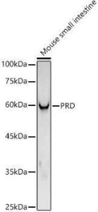 Anti-PRD Rabbit Monoclonal Antibody [clone: ARC3002]