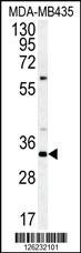 Anti-CCDC101 Rabbit Polyclonal Antibody