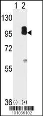 Anti-PRKG2 Rabbit Polyclonal Antibody