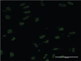 Anti-CRTC1 Mouse Monoclonal Antibody [clone: 8F9]