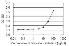 Anti-CBX5 Polyclonal Antibody Pair