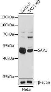 Western blot analysis of extracts from normal (control) and [KO Validated] SAV1 knockout (KO) HeLa cells, using Anti-SAV1 Antibody (A306668) at 1:1,000 dilution