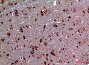 Immunohistochemical analysis of paraffin-embedded rat brain using Anti-TRPC3 Antibody