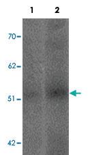 Anti-SLC39A14 Rabbit Polyclonal Antibody