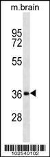 Anti-Dkk-2 Rabbit Polyclonal Antibody (APC (Allophycocyanin))