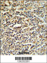 Anti-CCDC101 Rabbit Polyclonal Antibody