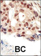 Anti-PRKG2 Rabbit Polyclonal Antibody