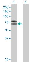 Anti-IL2RB Mouse Polyclonal Antibody