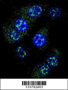 Anti-MGMT Rabbit Polyclonal Antibody (APC (Allophycocyanin))