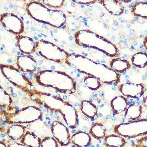 Immunohistochemistry analysis of paraffin-embedded mouse kidney using Anti-SAV1 Antibody (A306668) at a dilution of 1:100 (40X lens). Perform microwave antigen retrieval with 10 mM PBS buffer pH 7.2 before commencing with IHC staining protocol